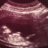 Futuras mamas febrero 2017 - 1