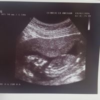 Futuras mamas febrero 2017 - 1