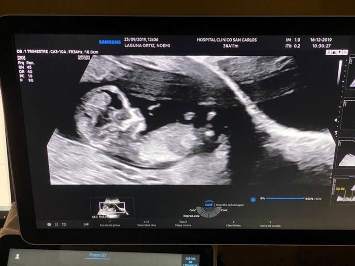 Futuras mamás Junio 2020 2