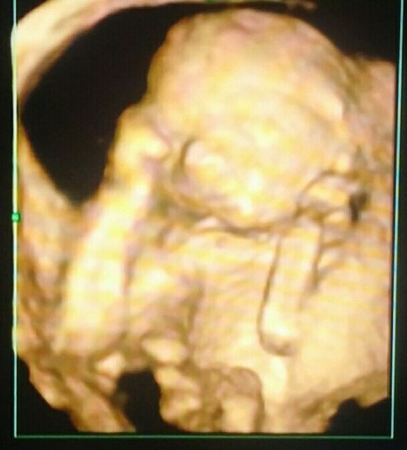 Mamis abril 2016 - 1