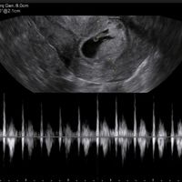 Futuras mamis septiembre 2022!!🤰 - 1