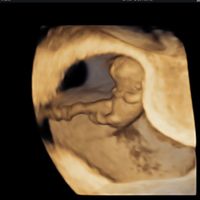 Futuras mamis septiembre 2022!!🤰 - 1