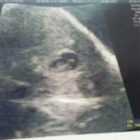 hola a todas!!! alguien sabria decirme si es niño o niña? estoy muy ansiosa!!!! es una eco abdominal