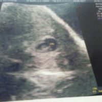 niño o niña? tengo mucha ansiedad de saberlo!!! ayuda chicas!!!