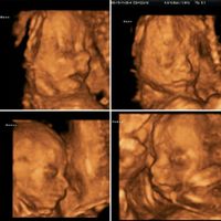 Mamis marzo 2016 - 1