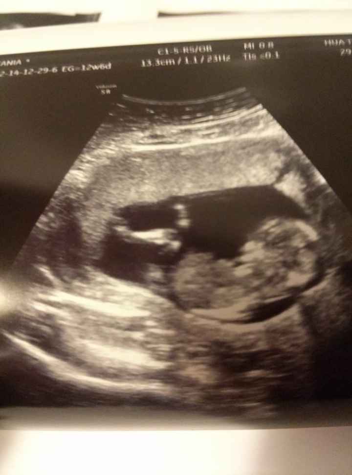 El consultorio de Lita para futuras mamis - 1