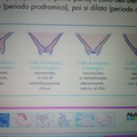 Dilatación 