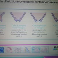 dilatacionb