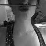 Neus