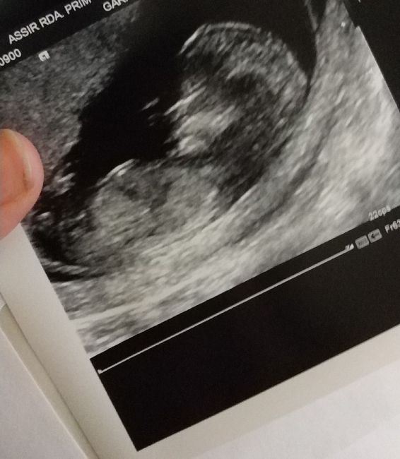 Futuras mamás septiembre 2019 - 1