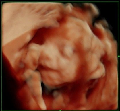 Futuras mamás septiembre 2019 - 1