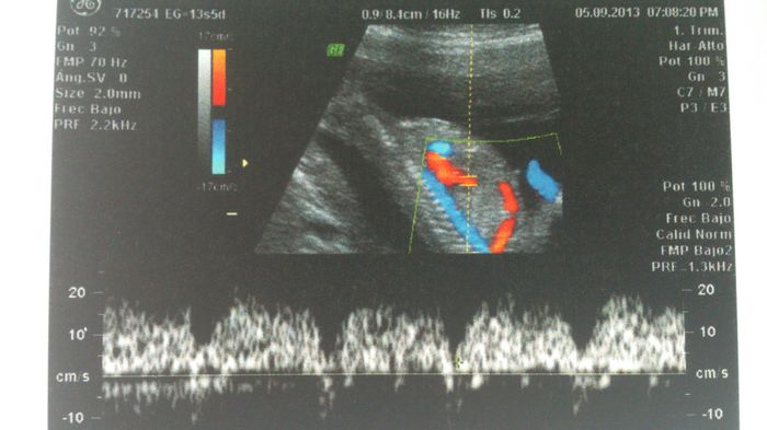 Ecografías - 4