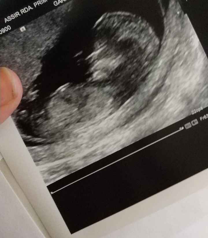 Futuras mamás septiembre 2019 - 1