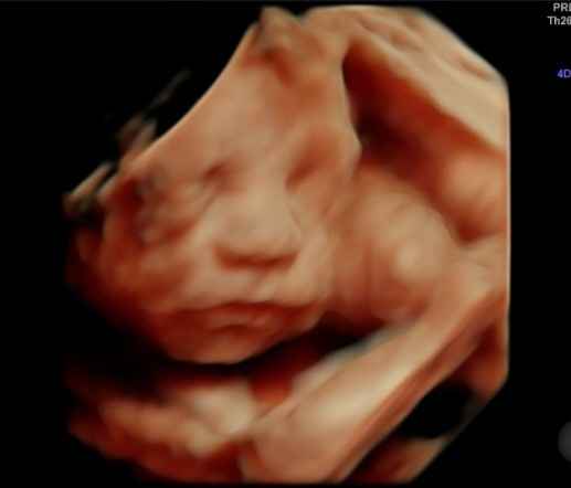 Futuras mamás septiembre 2019 - 1