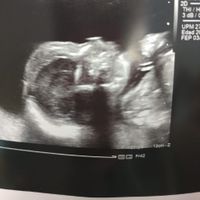 Futuras mamás septiembre 2019 - 1