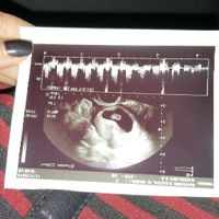 Futuras mamás junio 2016 - 1