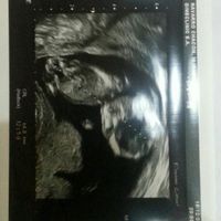Futuras mamás junio 2016 - 1