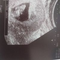 Futuras mamás Septiembre 2020 - 1