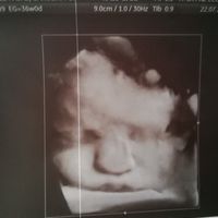 Futuras mamás agosto 2019 - 1