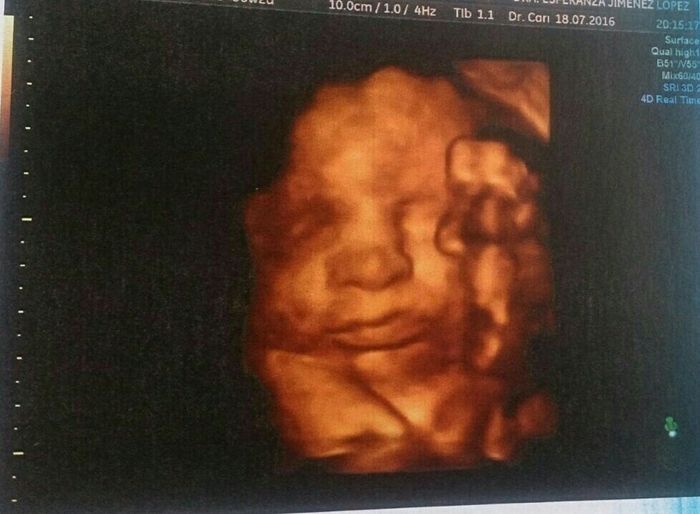 Futuras mamas septiembre 2016 - 1