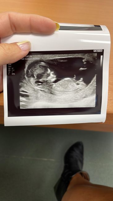 Futuras mamis Junio 2022!! - 1