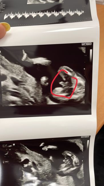 Futuras mamis Junio 2022!! - 1