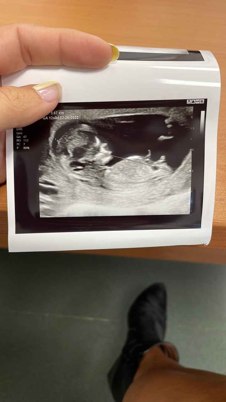 Futuras mamis Junio 2022!! 1