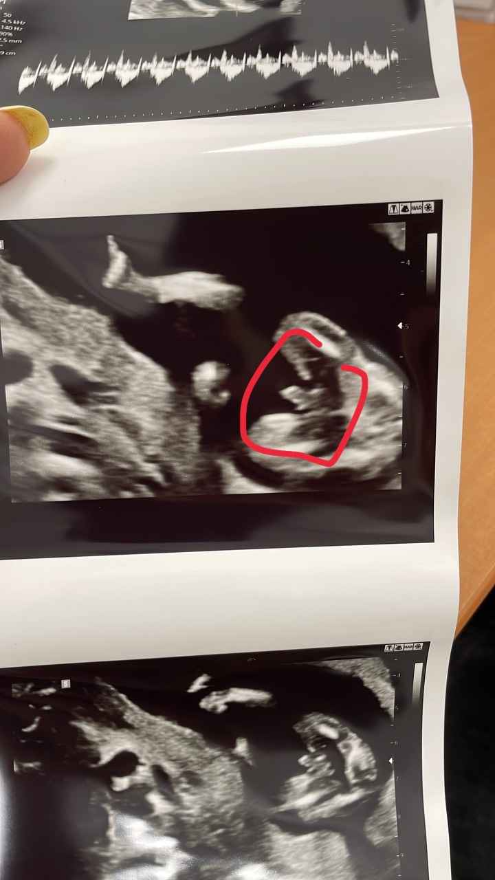 Futuras mamis Junio 2022!! 3