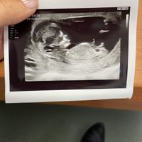 Futuras mamis Junio 2022!! - 1