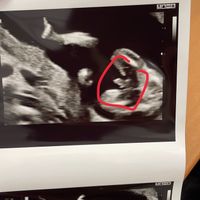 Futuras mamis Junio 2022!! - 1