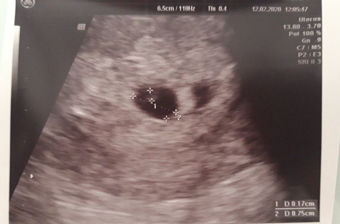 Futuras mamas octubre 2020 - 1