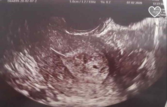 Futuras mamas octubre 2020 - 1