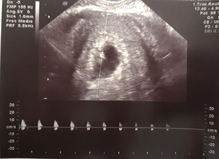 Futuras mamas octubre 2020 - 1