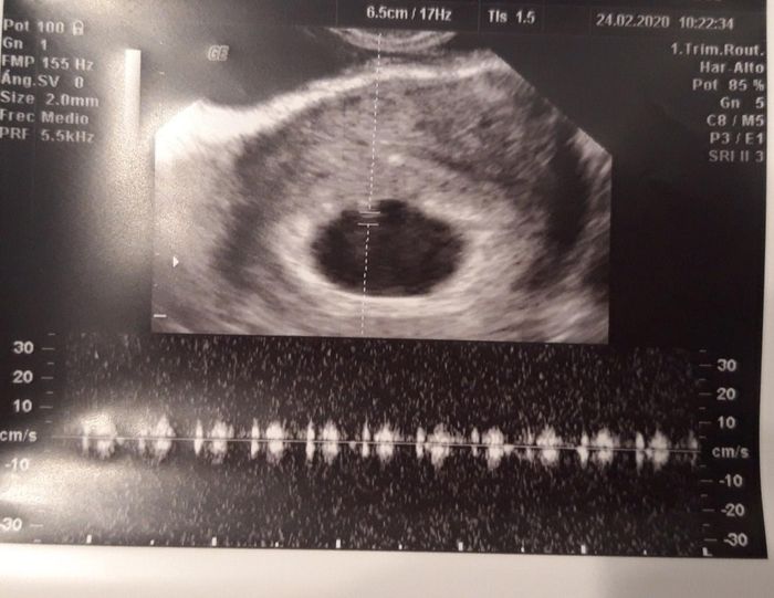 Futuras mamas octubre 2020 - 1