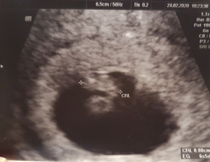 Futuras mamas octubre 2020 - 2