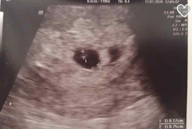 Futuras mamas octubre 2020 - 1