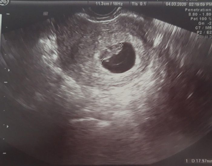 Futuras mamas octubre 2020 - 1