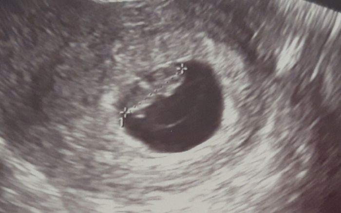 Futuras mamas octubre 2020 - 1