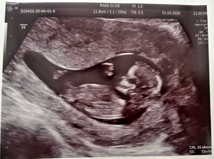 Futuras mamas octubre 2020 - 1