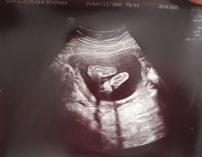 Futuras mamas octubre 2020 - 2