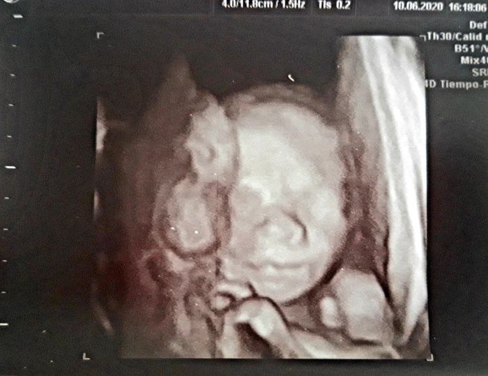 Futuras mamas octubre 2020 - 1