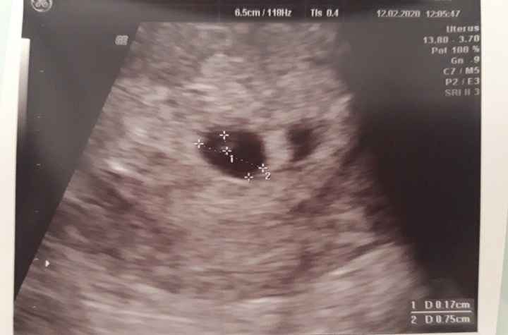 Futuras mamas octubre 2020 - 1