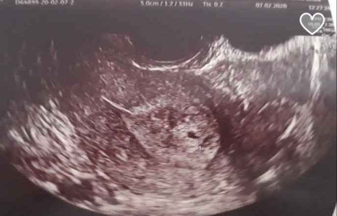 Futuras mamas octubre 2020 - 1