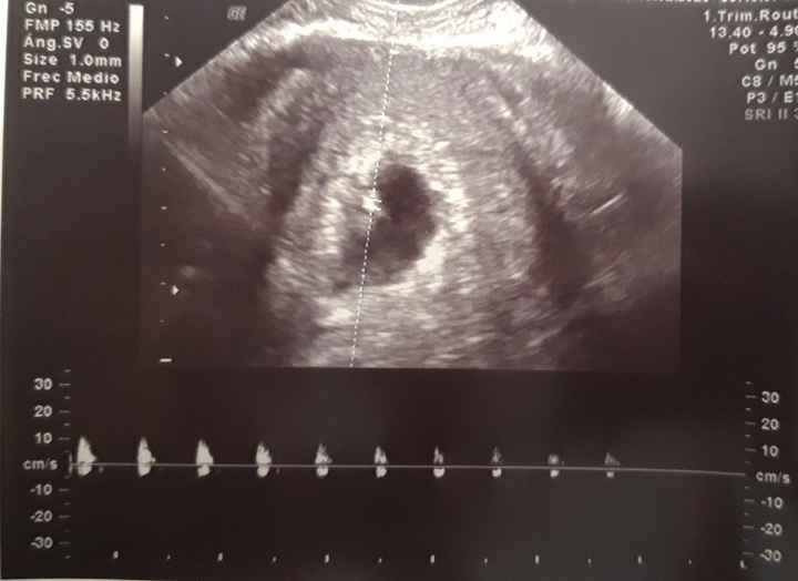 Futuras mamas octubre 2020 - 1