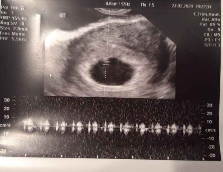Futuras mamas octubre 2020 - 1