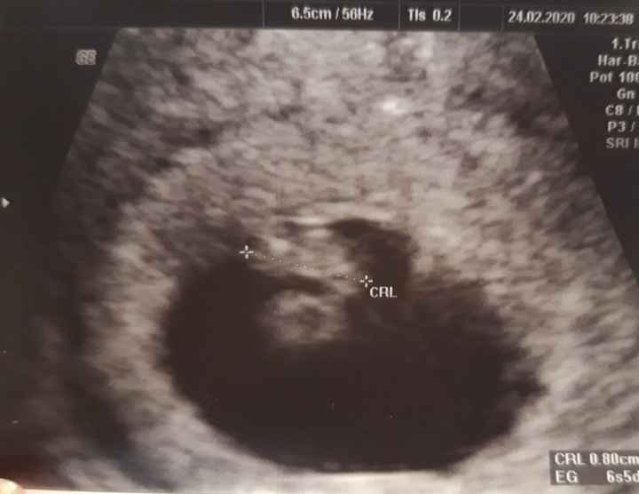 Futuras mamas octubre 2020 - 2