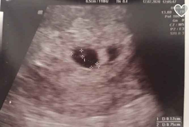 Futuras mamas octubre 2020 - 1