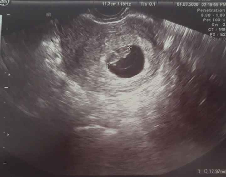 Futuras mamas octubre 2020 - 1