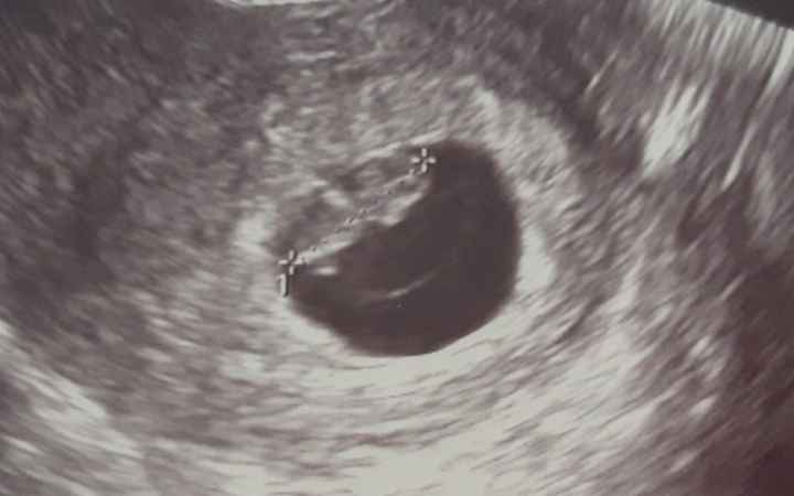 Futuras mamas octubre 2020 - 1