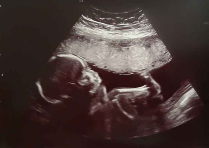 Futuras mamas octubre 2020 - 1